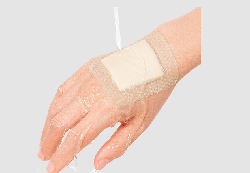Medical Wound Dressing
