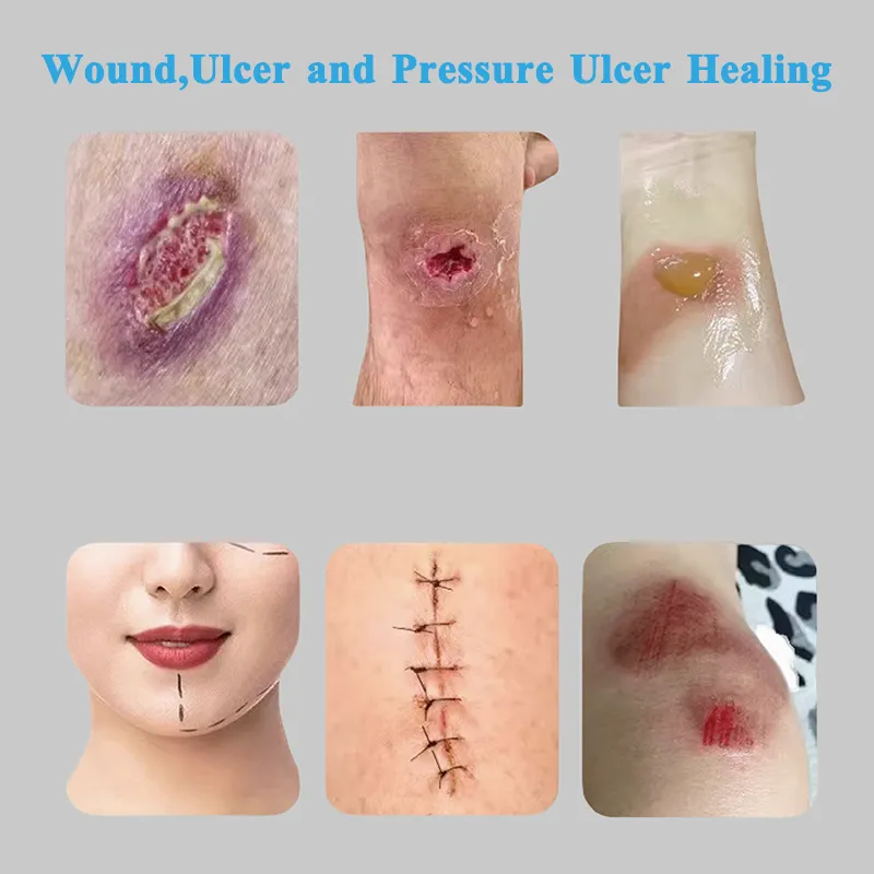 Applications of Seaweed Fiber Needle Punched Cotton